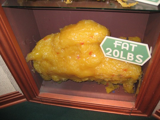 20lbs-of-fat